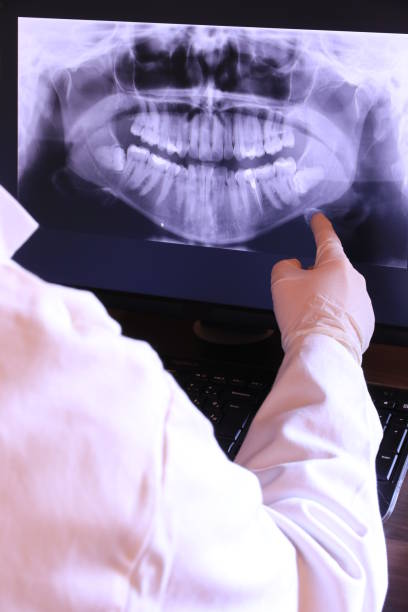 Best Dentist for Tooth Abscess  in Poplar Cotton Center, CA
