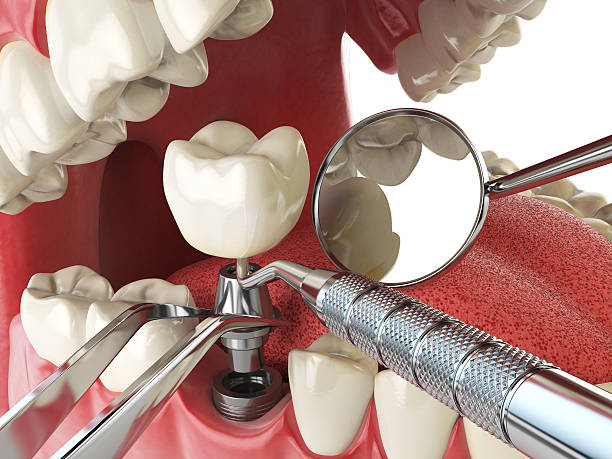 Best Emergency Tooth Extraction  in Poplar Cotton Center, CA