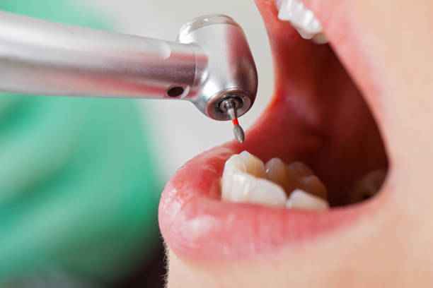 Best Cracked Tooth Emergency Dentist  in Poplar Cotton Center, CA